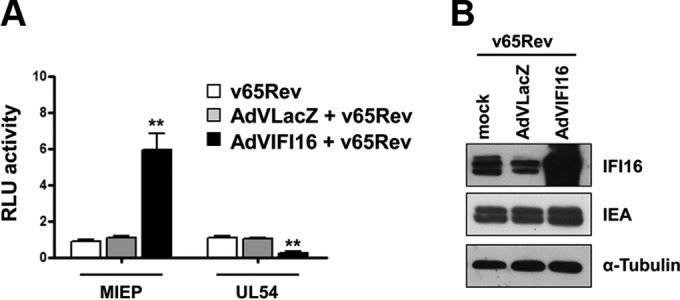 FIG 1