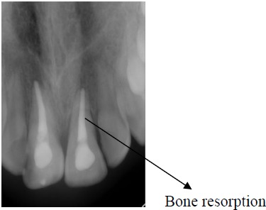 Fig. (4)