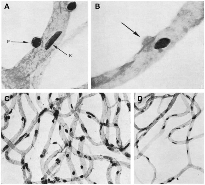 Fig. 17