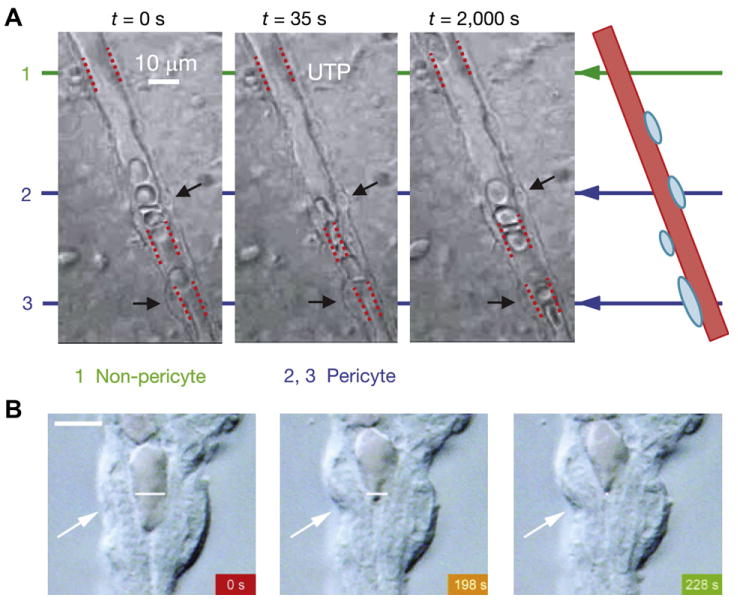 Fig. 11