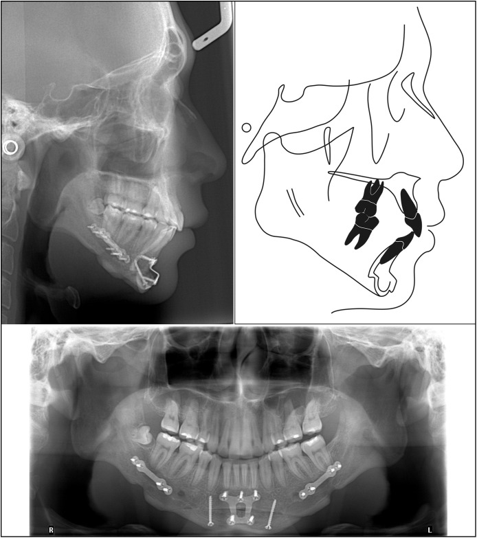 Figure 15.