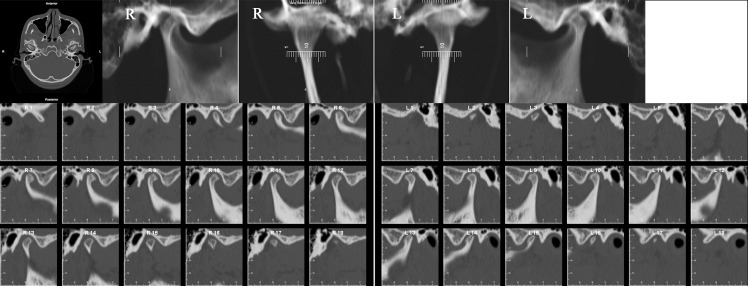 Figure 17.