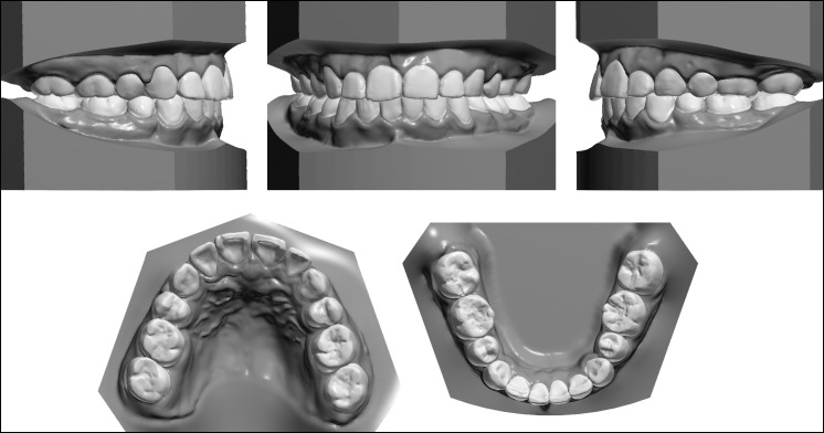 Figure 14.