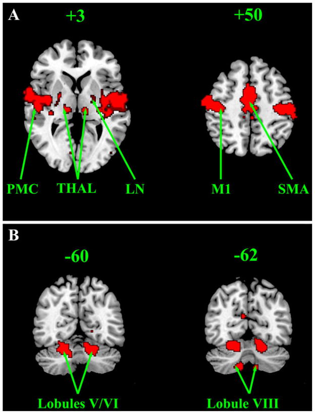 Fig. 11