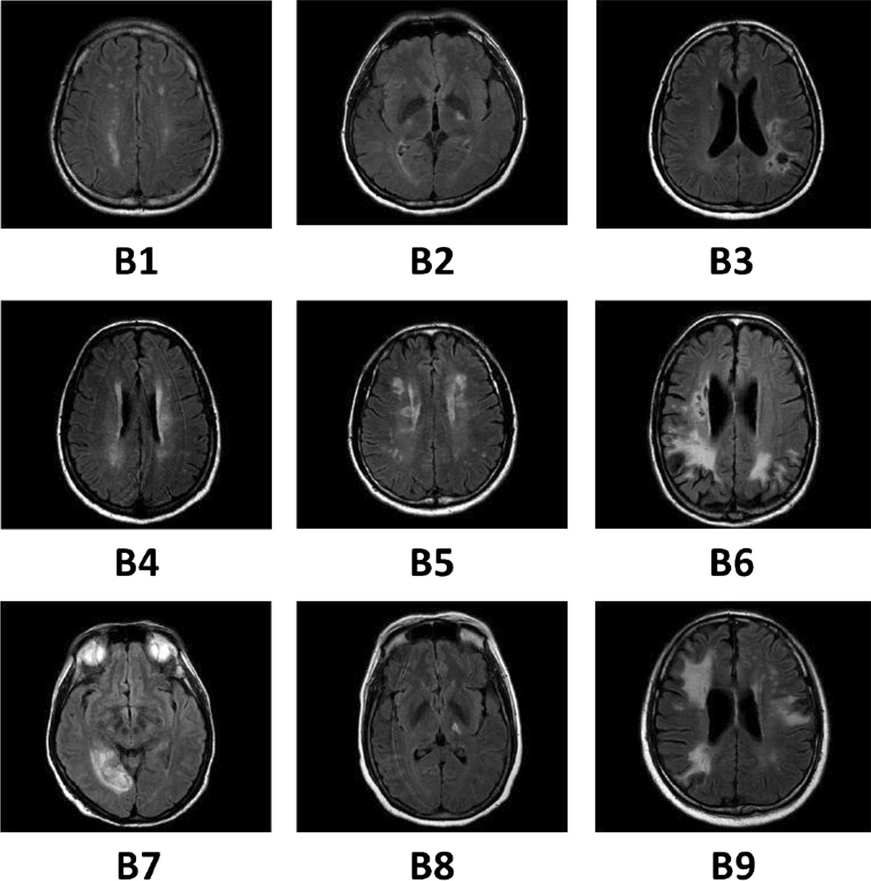 Fig. 4