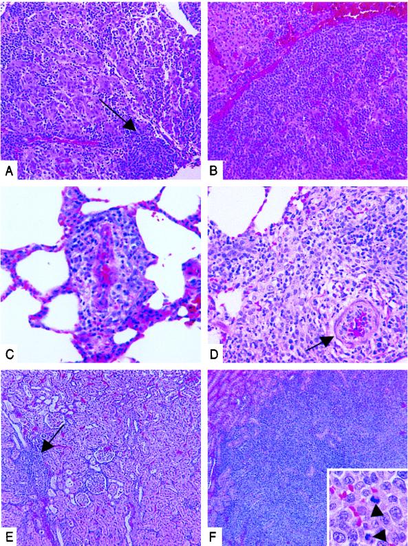 FIG. 6