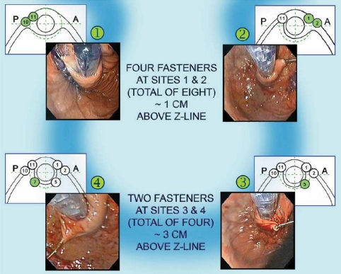 Fig. 1