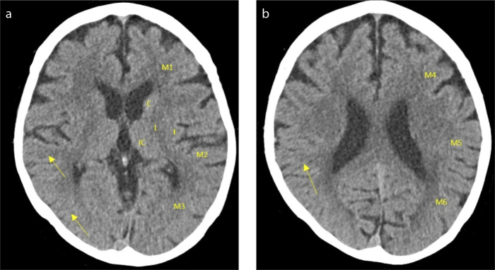 Figure 1. a, b