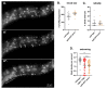Figure 1.
<b>
GFP11::
LMN-1
localization and function
</b>