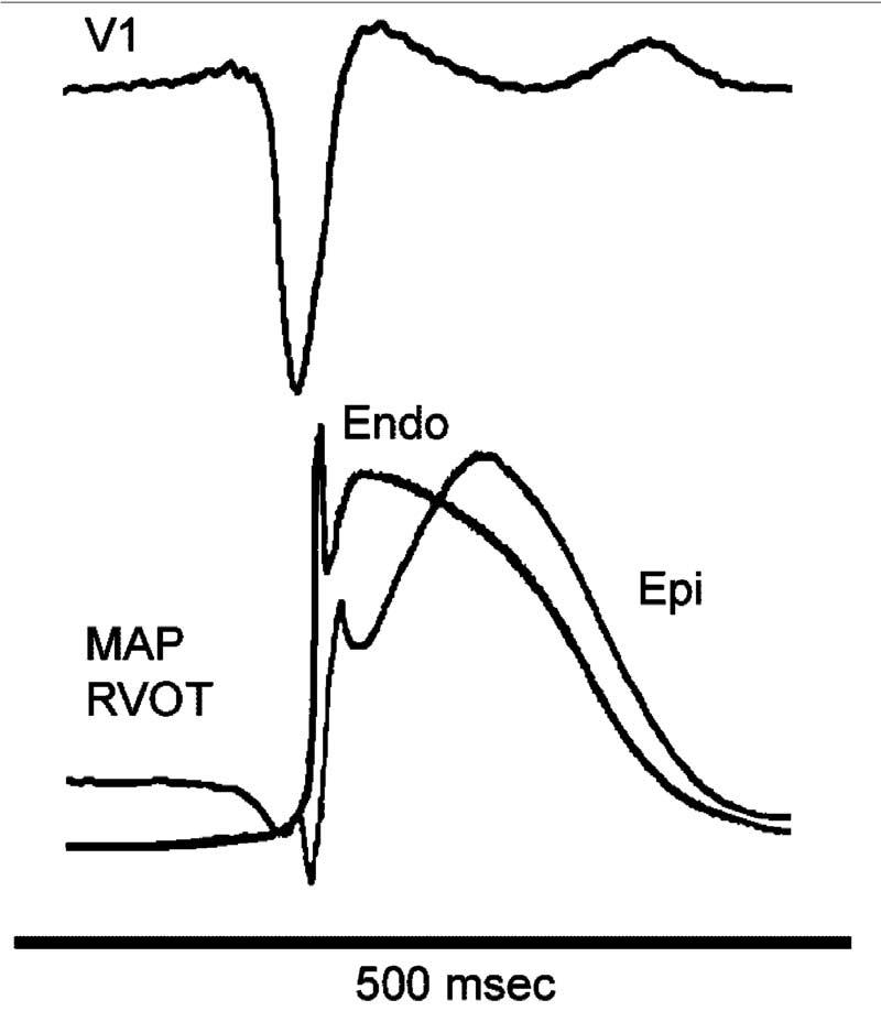 Fig 12