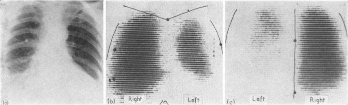 Fig. 6a b c