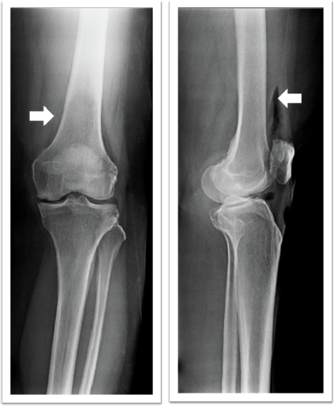 Fig. 4