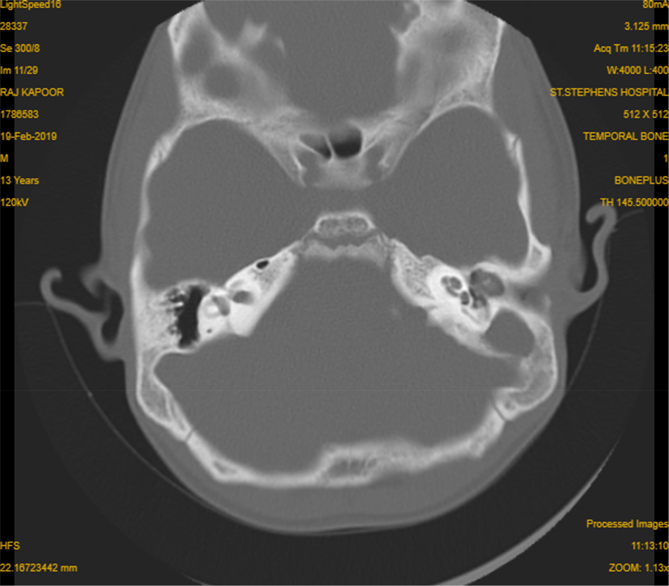 Fig. 2