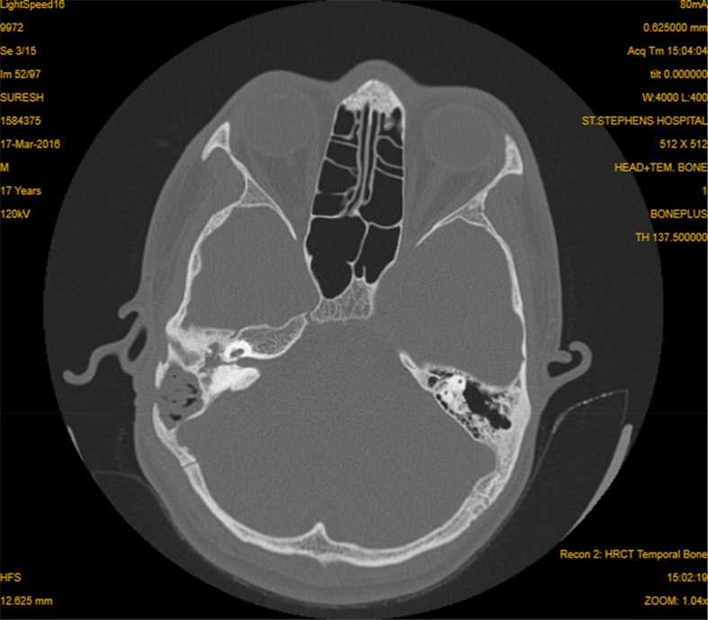 Fig. 1