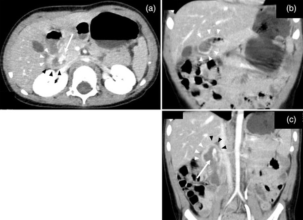 FIGURE 1