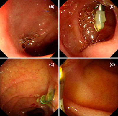 FIGURE 3