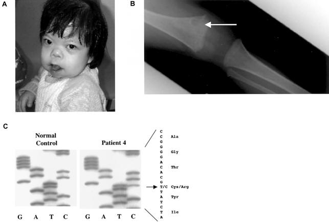 Figure  3