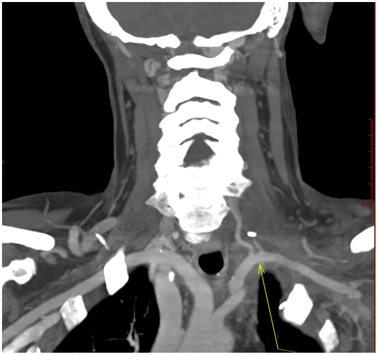 Fig 4