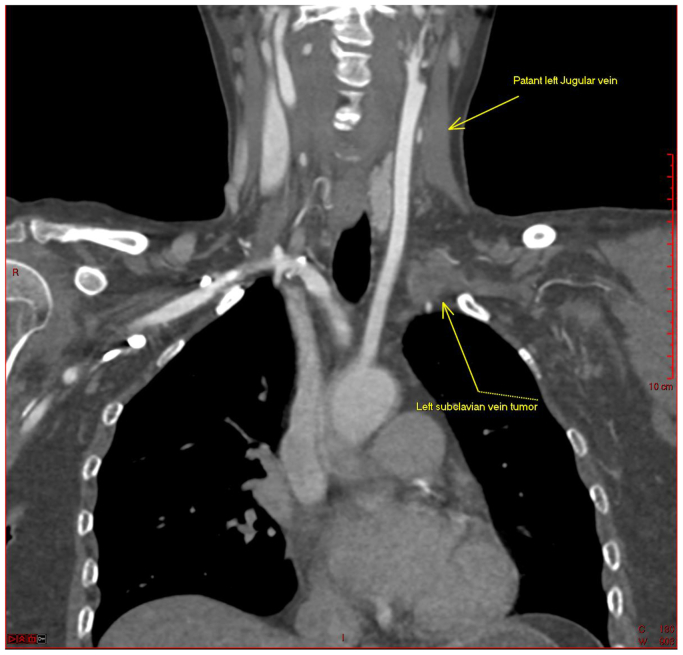 Fig 1