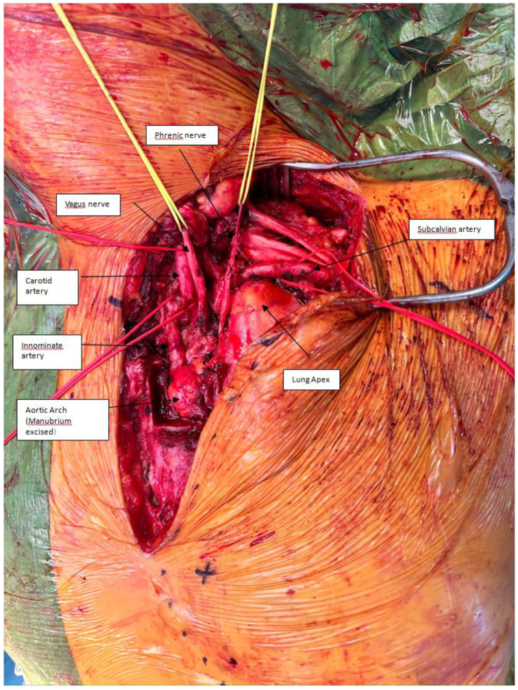Fig 3