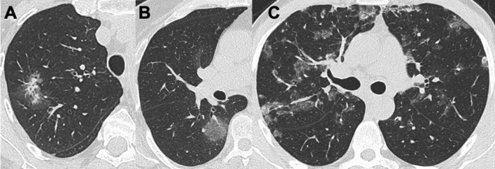 Fig. 11