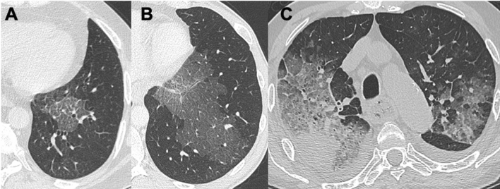 Fig. 10