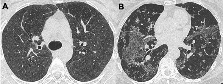 Fig. 12