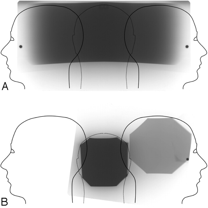 Fig 1.