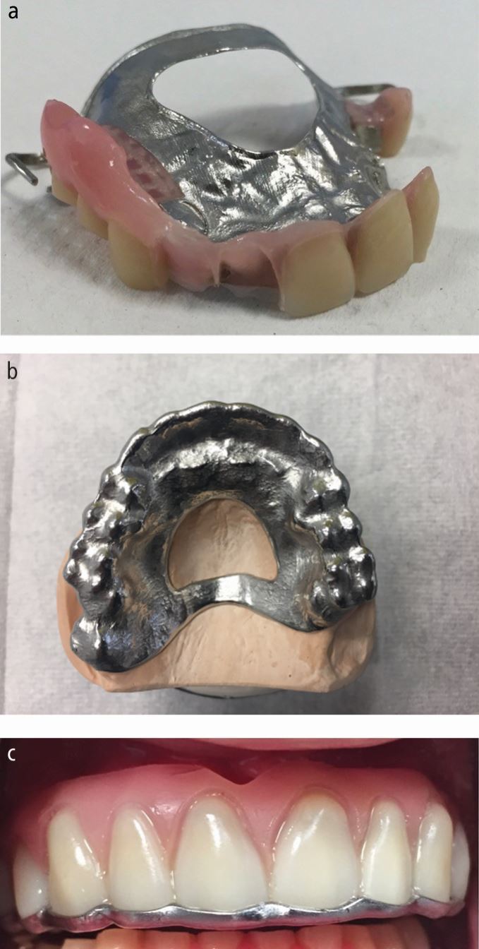 Fig. 11
