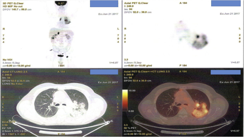 Fig. 4