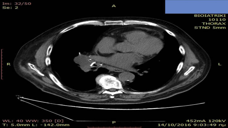 Fig. 1