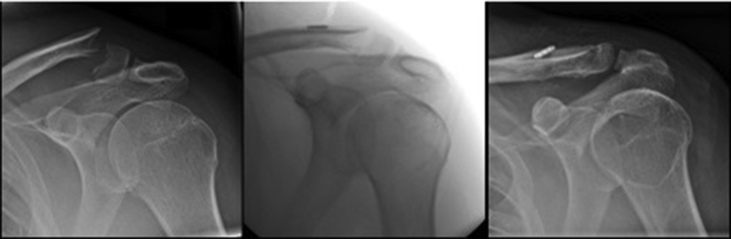 Fig. 3