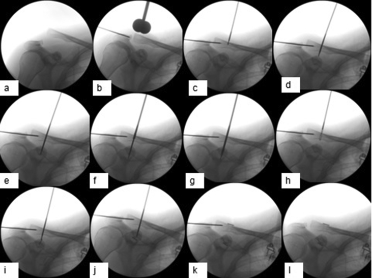 Fig. 2