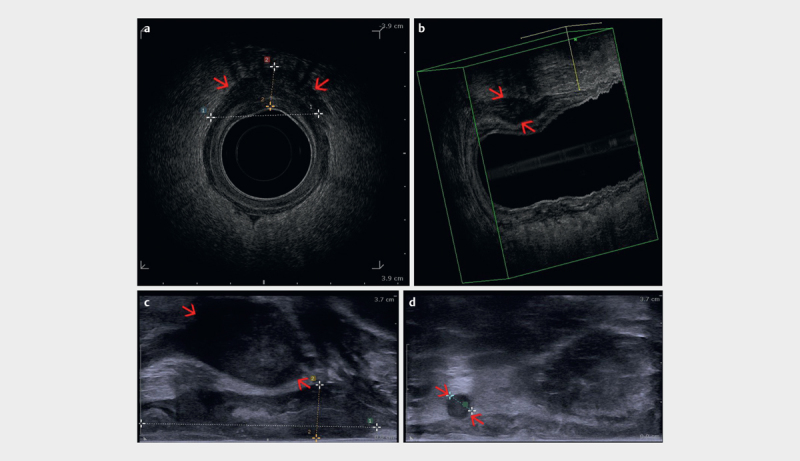 Fig. 11