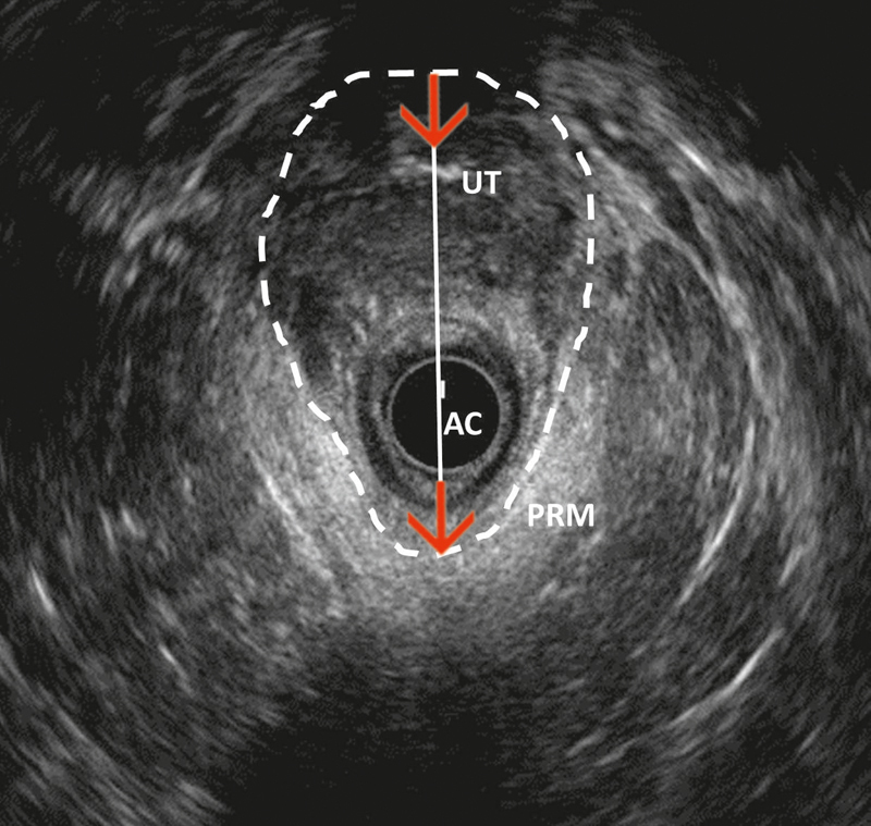 Fig. 17