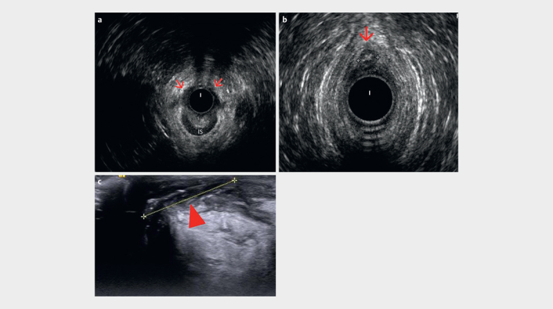 Fig. 15