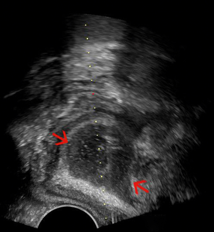 Fig. 22