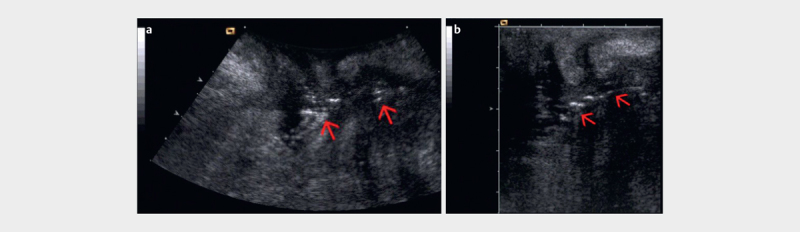 Fig. 19