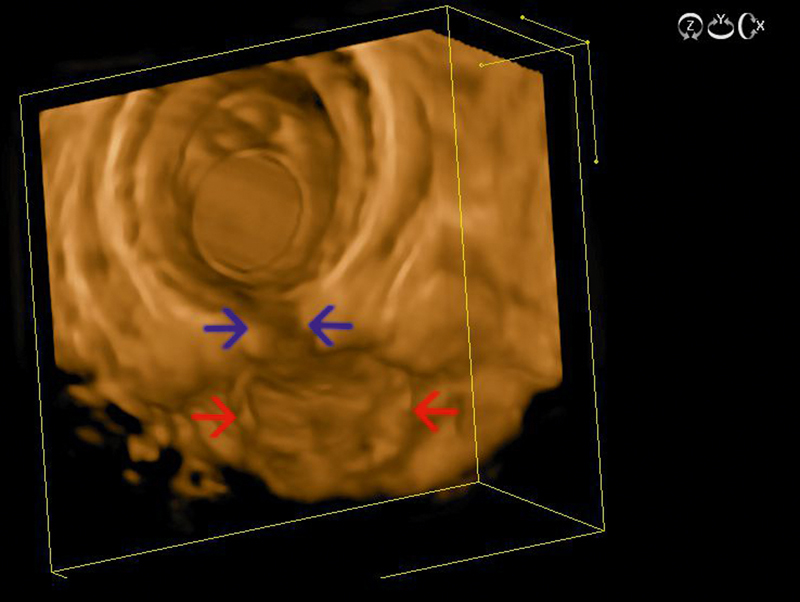 Fig. 12