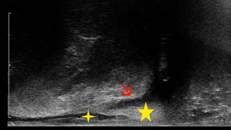 Fig. 16