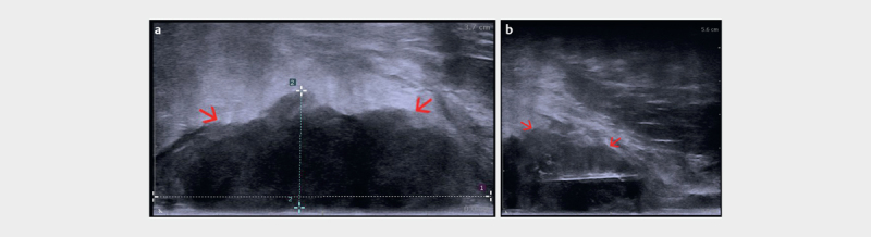 Fig. 18