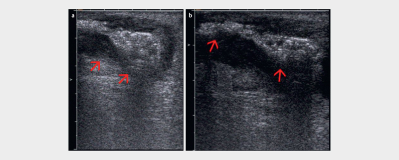 Fig. 21