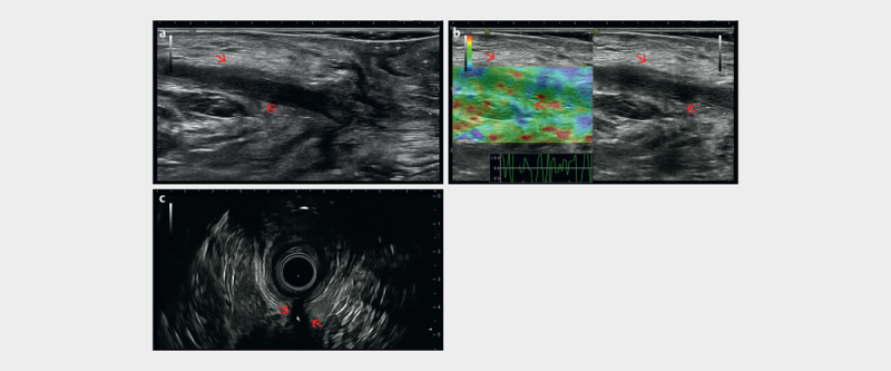 Fig. 20