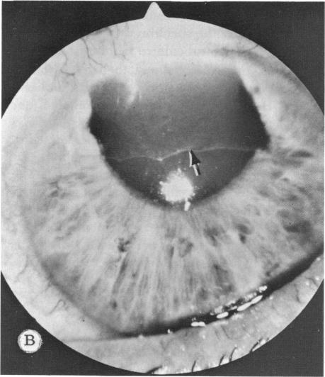 FIGURE 18 B