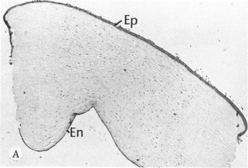 FIGURE 12 A