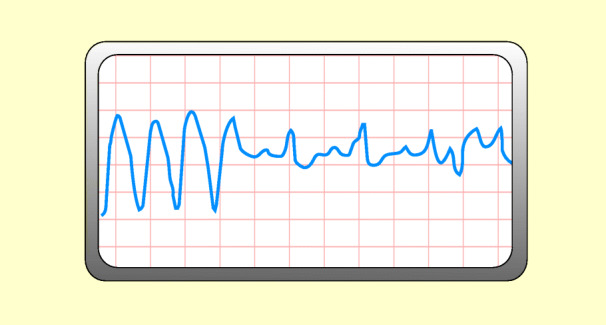 graphic file with name 6376_9_De_48_Fig11_HTML.jpg