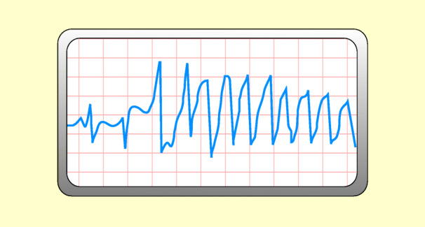 graphic file with name 6376_9_De_48_Fig12_HTML.jpg