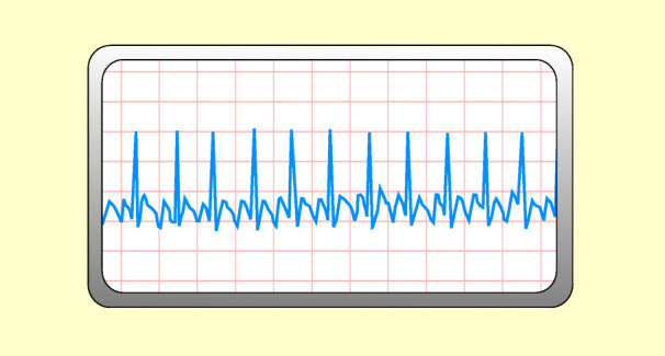 graphic file with name 6376_9_De_48_Fig7_HTML.jpg
