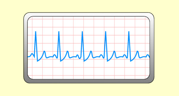 graphic file with name 6376_9_De_48_Fig1_HTML.jpg