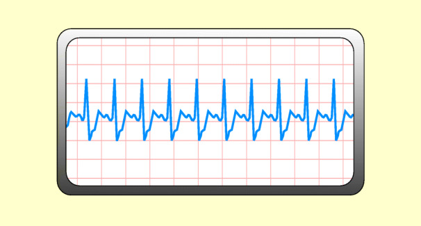graphic file with name 6376_9_De_48_Fig3_HTML.jpg